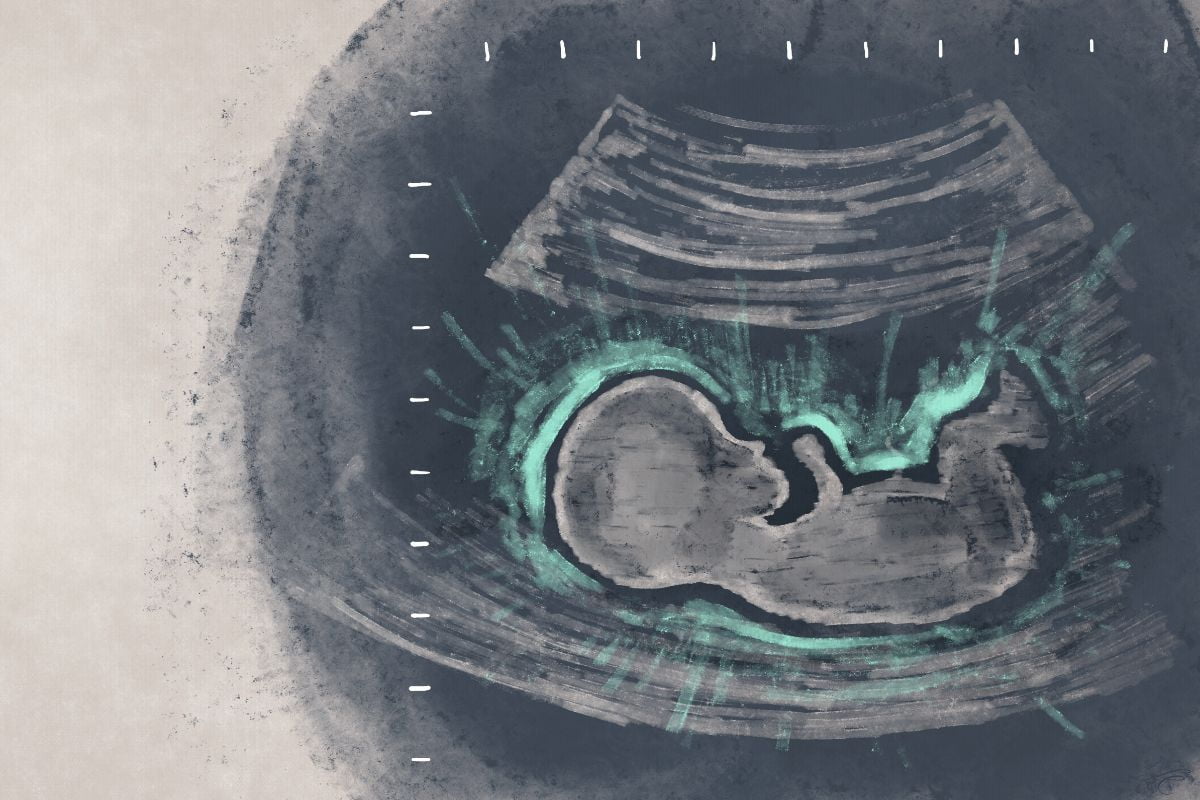 irreductibles_julian_hoyos_21_02_23 (1)